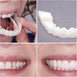 Snap On Smile Veneers Moldable False Artificial Braces Teeth Kits For Men And Women