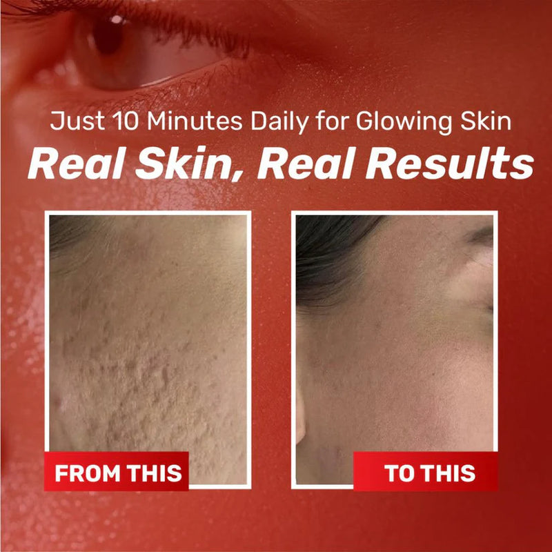 Chalonese Brightening Cream – Buy 1 Get 1 Free