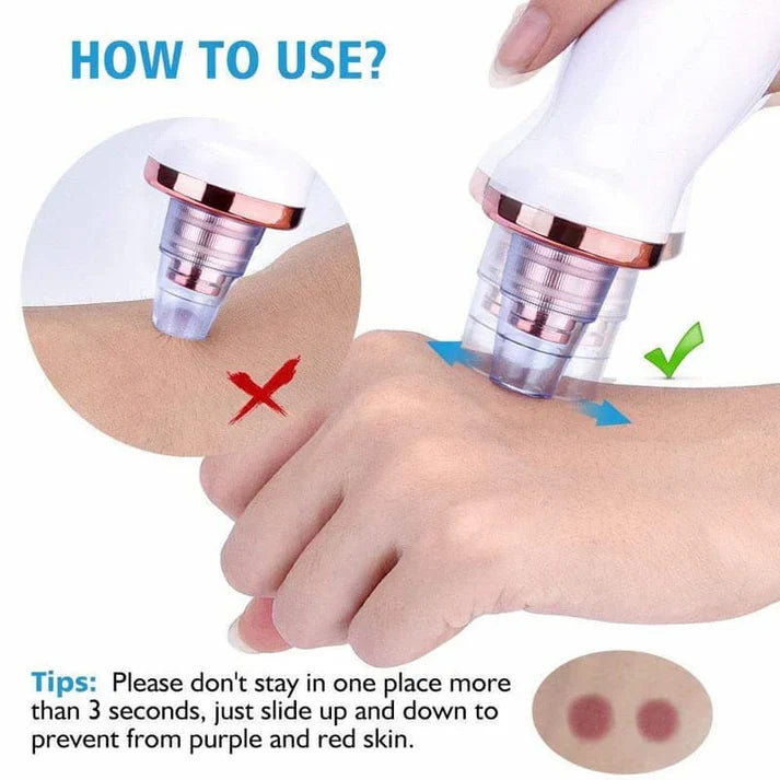 Acne Pore Cleaner & Black Head Remover